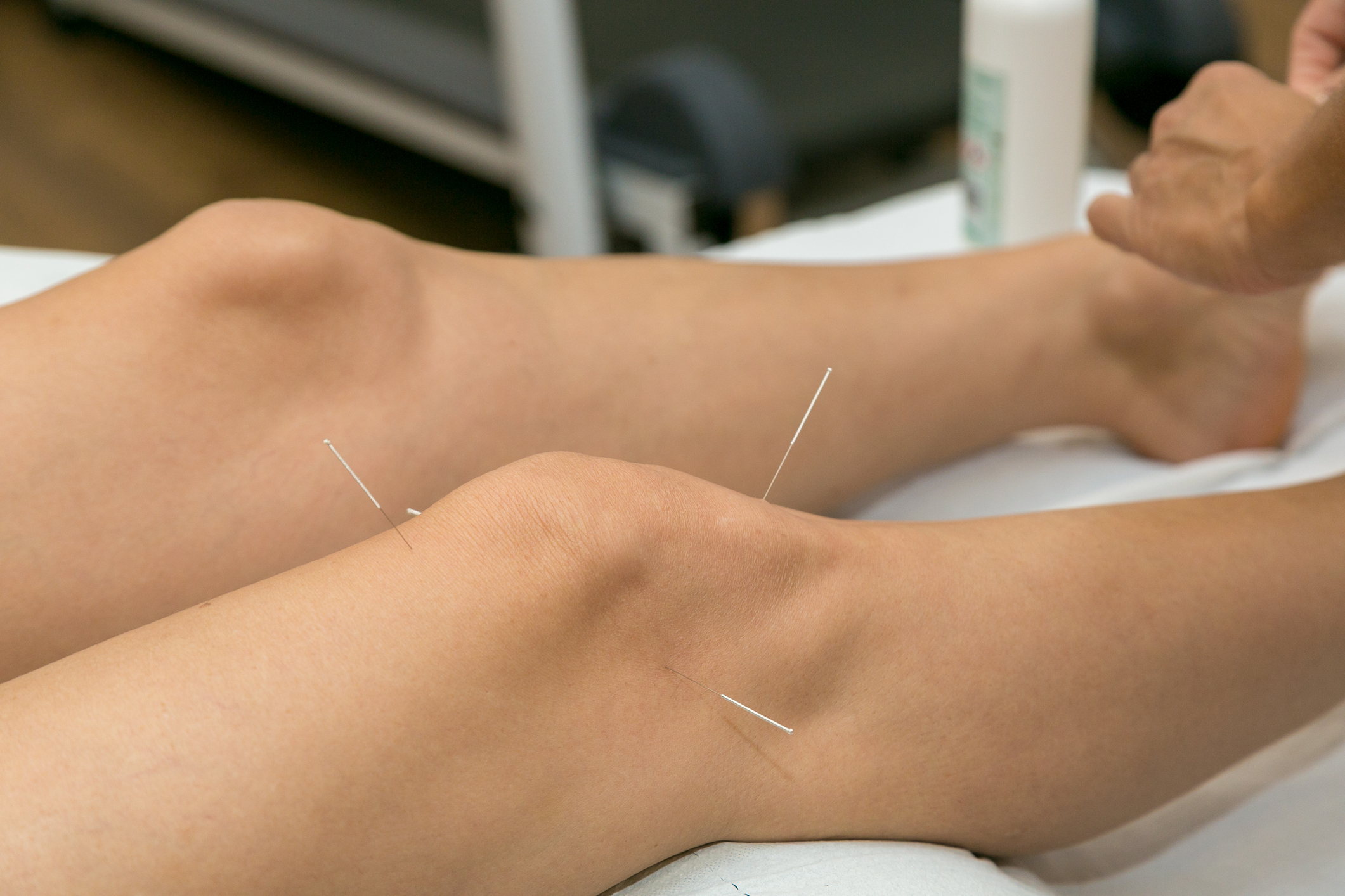 Acupuncture On The Knee, Treatment Of Osteoarthritis In The Knee